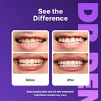 DRDENT Purple Oral Teeth Whitening Strips - 7/21 Sessions - Gentle Non-Sensitive, Peroxide-Free, Radiant Teeth Whitening Solution